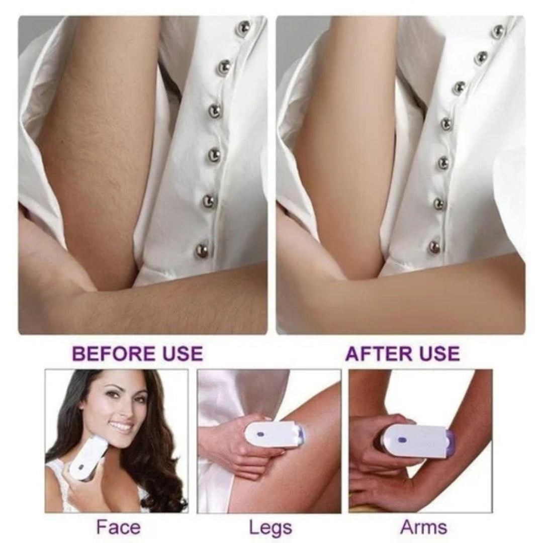 Shenish™ Yes Polished Perfection Face Body Instant Pain Free Hair Removal