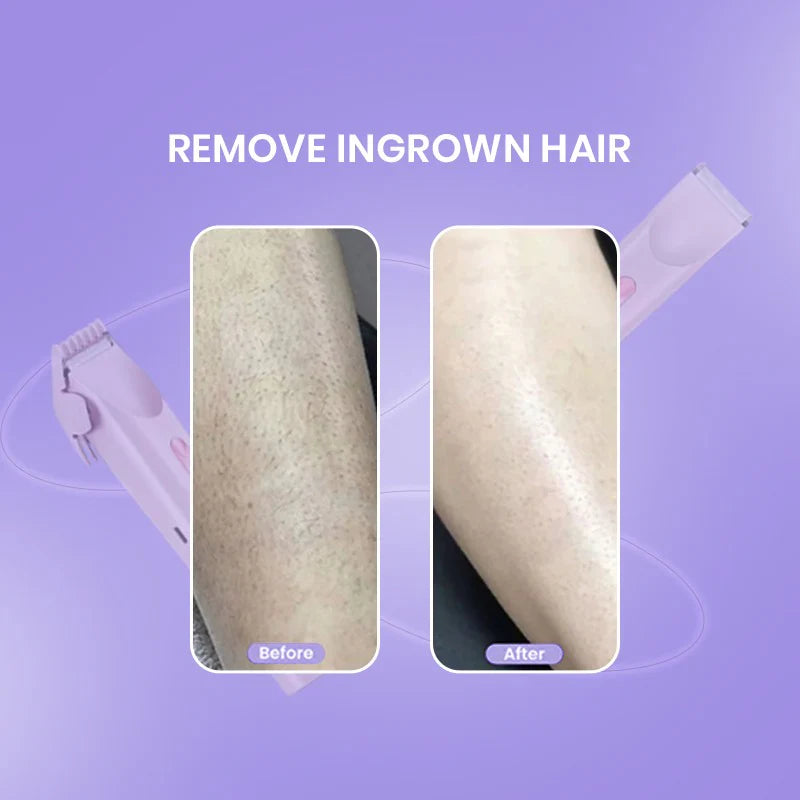 Shenish™ SmoothGlide 2-in-1 Shaver – No Pain, No Cuts