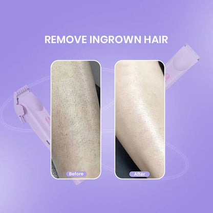 Shenish™ SmoothGlide 2-in-1 Shaver – No Pain, No Cuts