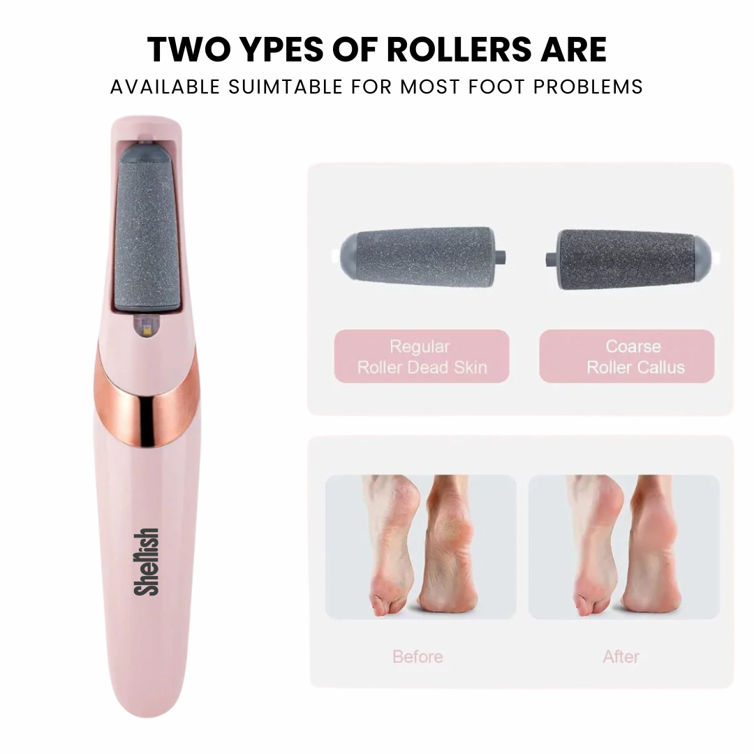 Shenish™ Callus Remover