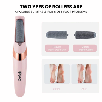 Shenish™ Callus Remover