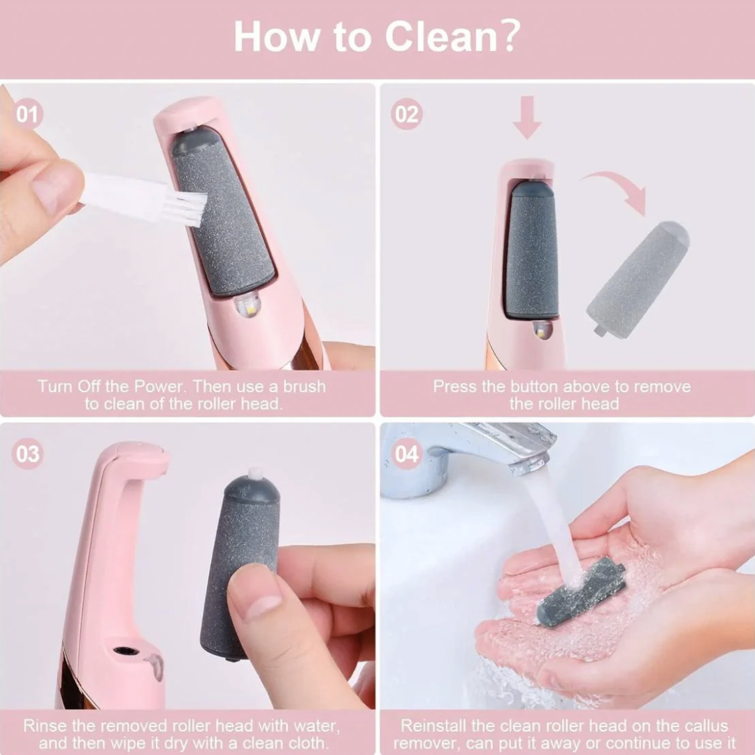 Shenish™ Callus Remover