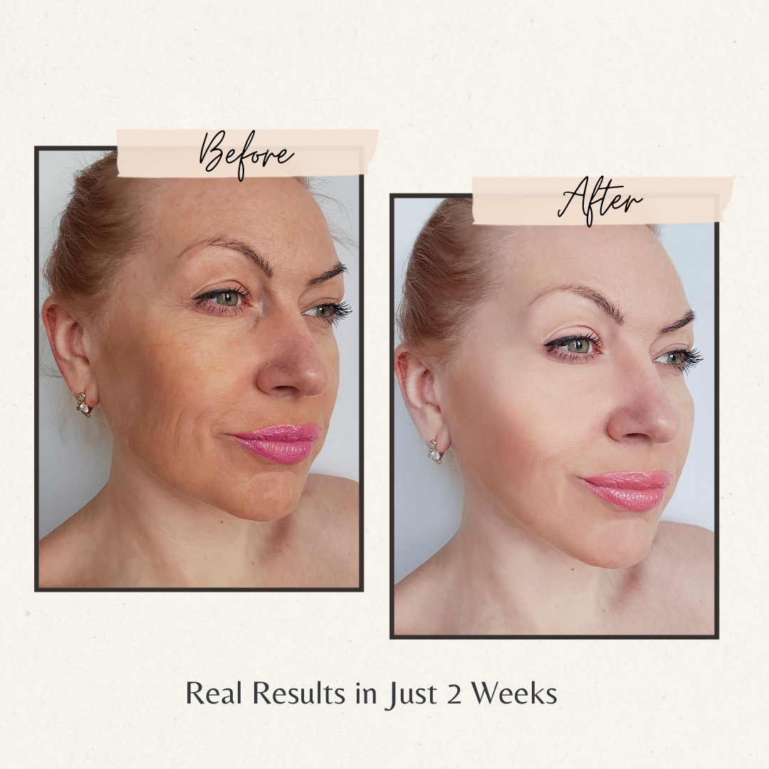 Shenish™ 4-in-1 Skincare Value Bundle