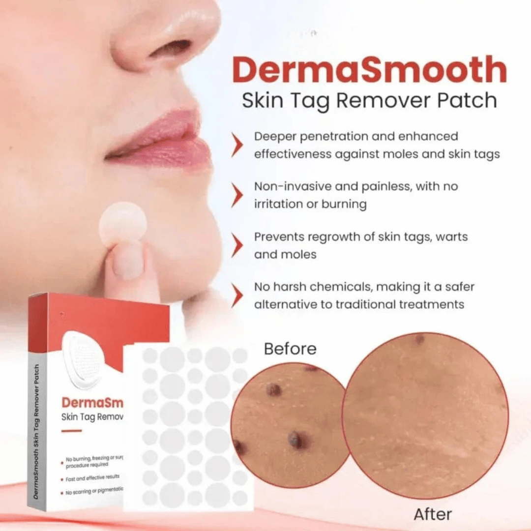 Derma Smooth Skin Patch – Instant Acne Or Skin Tag Treatment